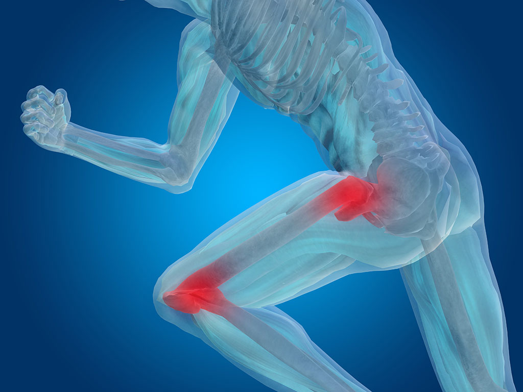 muscle and bones graphic with red spots on the hip and knee that shows using primal 7 in physical therapy